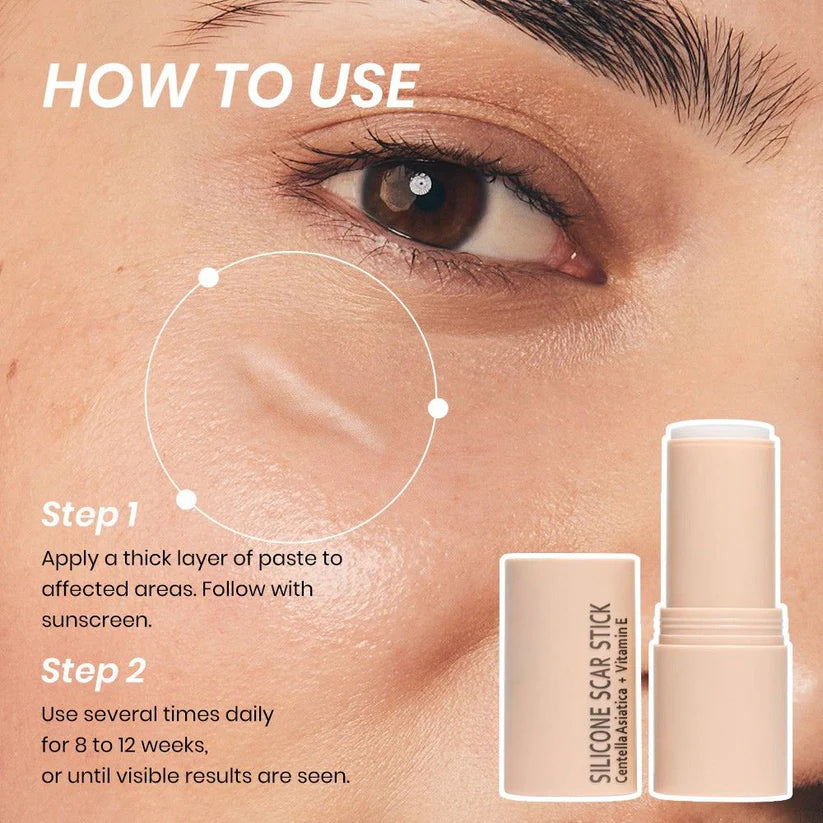 Silicone Scar Stick